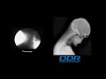 x ray that moves ddr digital dynamic radiograhpy by konica minolta