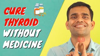 Cure Thyroid Without Medicine | How To Cure Thyroid Naturally Without Medicine
