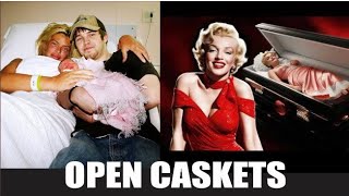 50 Rare Historic Open Casket Photos of Iconic Figures