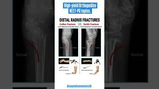 Daily Dose: High-Yield Topics for NEET PG, FMGE \u0026 INI-CET Success #orthopedics #fmge #neet #inicet