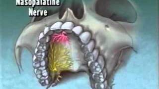 Maxillary Anatomy