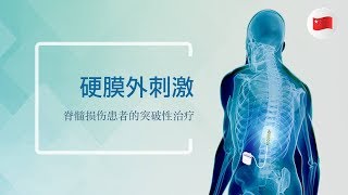 硬膜外刺激: 脊髓损伤患者的突破性治疗