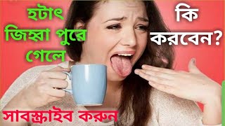 হটাৎ জিহ্বা পুরে গেলে কি করবেন/What to do when suddenly the tongue burns