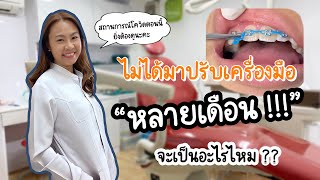 จัดฟัน แต่ไม่ได้ปรับเครื่องมือหลายเดือน จะเป็นอะไรไหม | คุยจัดฟัน | ทันตกรรมฟ้าใส