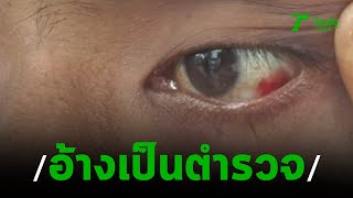 หนุ่มร้องถูกชายอ้างเป็นตร.ซ้อมน่วม | 22-08-62 | ไทยรัฐนิวส์โชว์