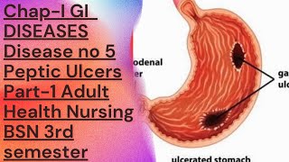 Adult Health Nursing/ BSN 3rd semester [chap #1 GI-Diseases] ,,Disease No 5 Peptic Ulcers[ part #1]
