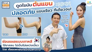 ดูดไขมันแขน เทคนิคเกาหลี ลดได้จริง ไม่เห็นแผล