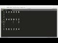Search In Rotated Sorted Array [LeetCode 33] | Binary Search | Approach and Intuition