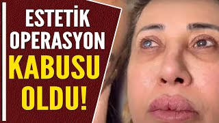 ESTETİK OPERASYONU KABUSU OLDU!