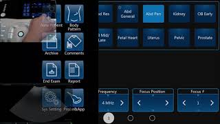 Introduction to VINNO Ultrasound Software: Entering a New Patient