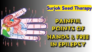 PAINFUL POINTS OF THE HANDS & FEET IN EPILEPSY