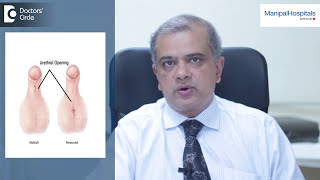 What is Hypospadias? | hypospadias signs and symptoms | Dr. CN Radhakrishnan - Manipal Hospitals