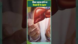 Liver Damage Signs: लिवर खराब होने पर दिखते हैं ये लक्षण|Medicalluyspeaking||