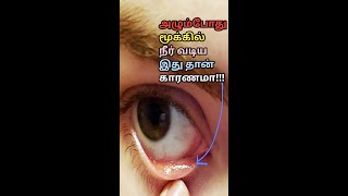 அழும்போது ஏன் மூக்கு ஒழுகுகிறது #shorts | Why do we have runny nose when we cry | Lacrimal Punctum