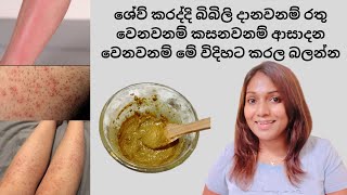 කසන්නෙ රතුවෙන්නෙ බිබිලි දාන්නෙ ආසාදන වෙන්නෙ නැතුව ශේව් කරන්නේ මෙහෙමයි/correct way to body shaving