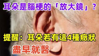 耳朵是腦梗的「放大鏡」？提醒：耳朵若有這4種癥狀，盡早就醫#健康常識#養生保健#健康#健康飲食