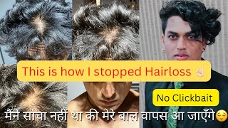 Hairfall ya Hairloss 100% ruk jayega ye karne se☝🏻Mere khud 20% baal chale gye the| Part-2