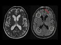 how to read an mri of the brain