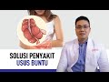 Usus buntu: Gejala, Penyebab, dan Cara Mengatasinya | Kata Dokter