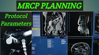 MRCP PLANNING step by step #MRCP planning or protocol #Mrcp planning GE machine