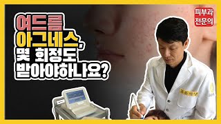 [아그네스 개발 병원] 여드름 아그네스, 몇 회정도 치료받아야 할까요?