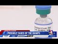 Possible cases of the mumps in Utah