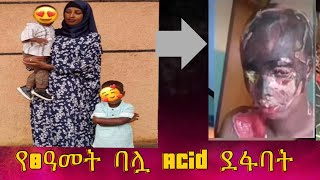 የ8 ዓመት ባሏ Acid ደፋባት🥹 Ayantu Mustefa አያንቱ ሙስጠፋ