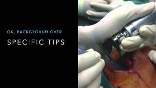 TiCME Glidescope vs Mac