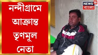 Nandigram : নন্দীগ্রামে আক্রান্ত TMC নেতা! BJP র বিরুদ্ধে হামলার অভিযোগ । Bangla News