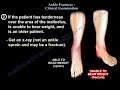 Ankle Fractures , Clinical Examination - Everything You Need To Know - Dr. Nabil Ebraheim