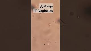 T. Vaginales @D.ameensif #مختبرات #تحاليل #فحص #صحة #laboratory #lab #medical