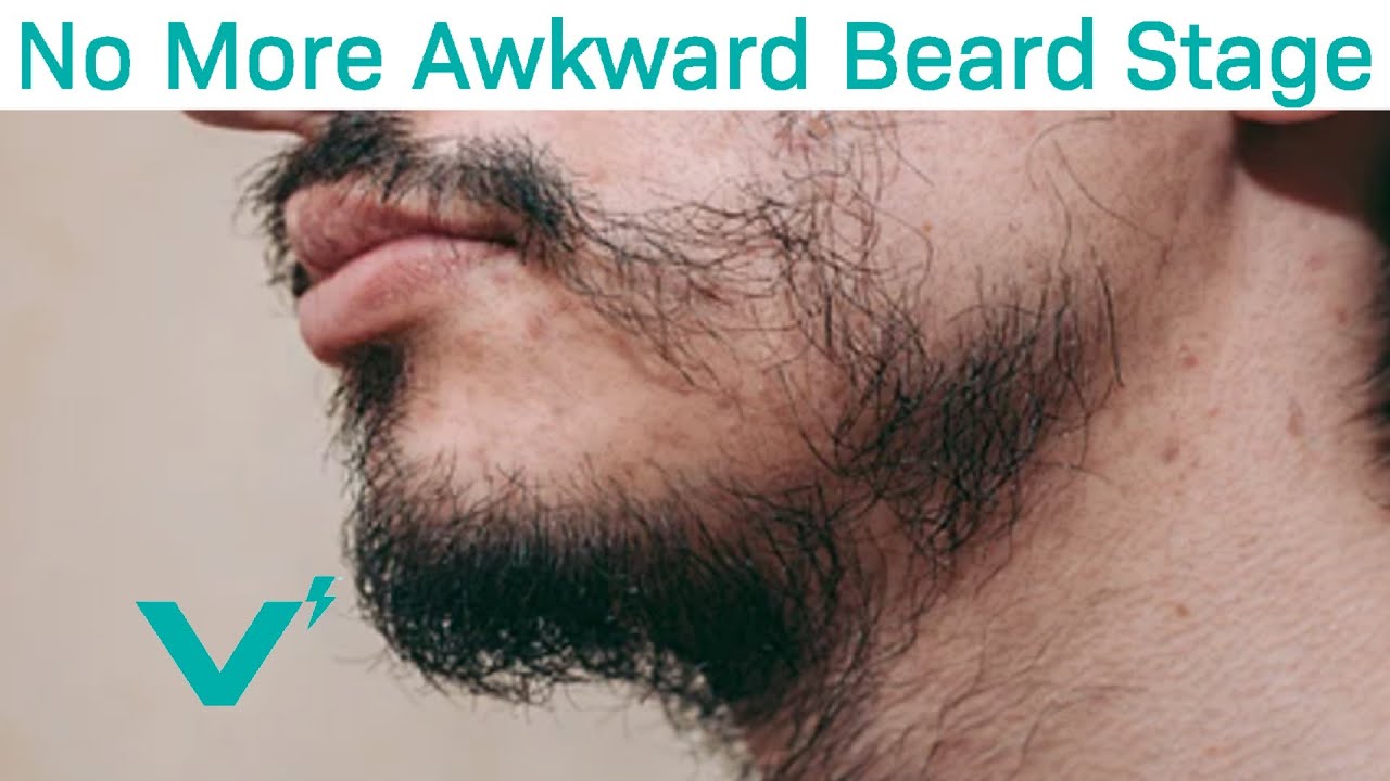 Skip The "Awkward Beard Stage" With These Tips - YouTube