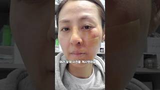 미스코리아 전혜진 끔찍한 사고근황