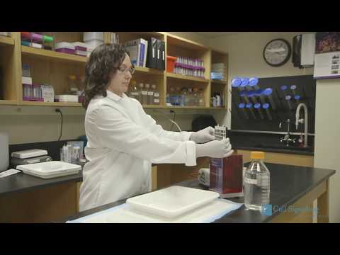Western Blotting Protocol Western Blotting Protocol