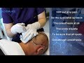 no pain anymore....painless anesthesia technique_ estepalace center for hair transplant