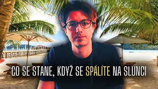 Co se děje s tělem, když se spálíte na slunci