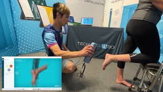 Plantar surface scanning with MSoft and the Einstar scanner