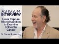 Examining Colorectal Cancer Using Laser Capture Microdissection - ASHG 2014