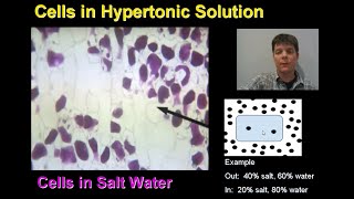 Osmosis in Red Onion Cells - Mr Pauller