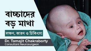 শিশুদের বড় মাথা বা হাইড্রোসেফালাস   লক্ষণ, কারণ ও চিকিৎসা  | Hydrocephalus Baby Treatment in benga