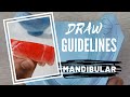 Guide lines for the mandibular cast | CHEAT LINES