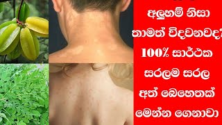 අලුහම් වලට මේ අත් බෙහෙත කරලා බලන්න