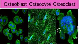 Difference between osteoblast osteocyte and osteoclast