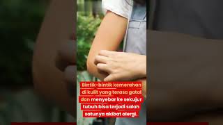 Kenapa Muncul Bintik Merah Gatal dan Menyebar?