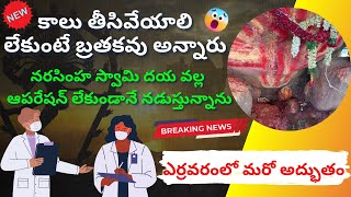 కాలు తీసివేయాలి లేకుంటే బ్రతకవు అన్నారు | ఎర్రవరం బాల ఉగ్ర నరసింహ స్వామినే నన్ను కాపాడారు |