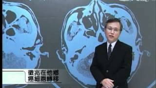 20120607《大愛醫生館》徵兆在他鄉 癌細胞轉移