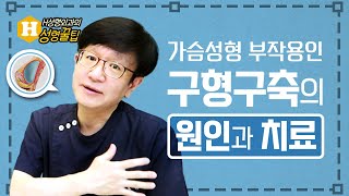 가슴성형 부작용인 구형구축의 원인과 치료는?