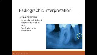 Periapical lesions 18 minutes