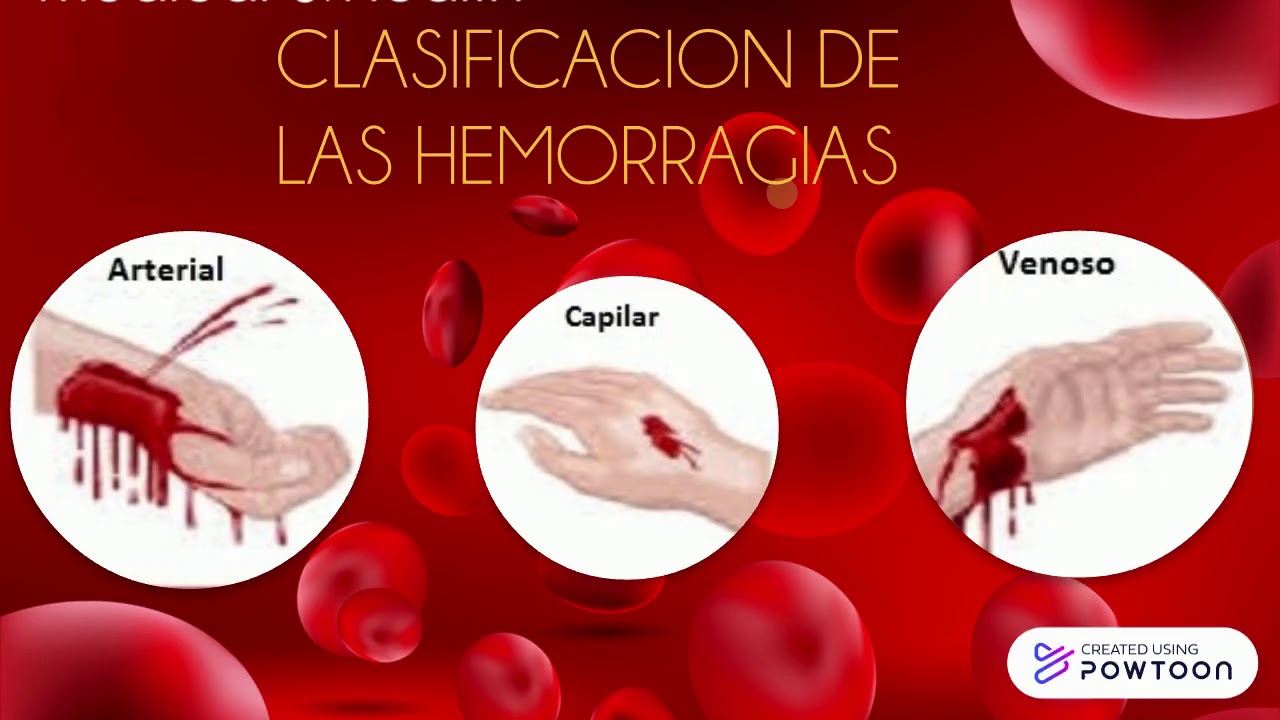 Hemorragia Youtube