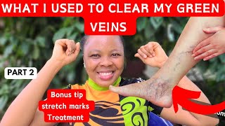 How To Clear Green Veins Fast: 3 Products That will CLEAR SPIDER veins,green veins, varicose veins